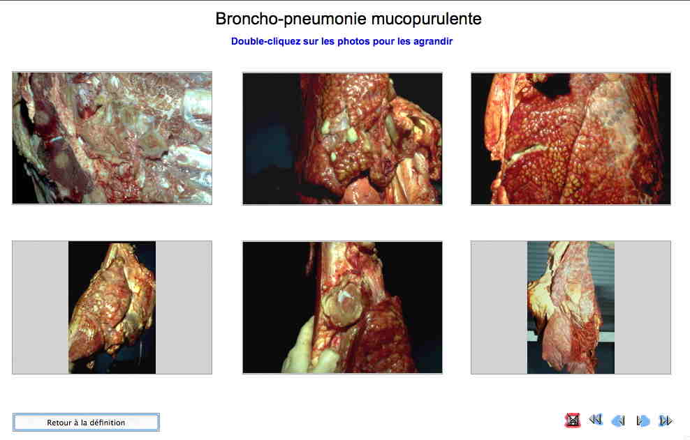 Photographies de bronchopneumonie