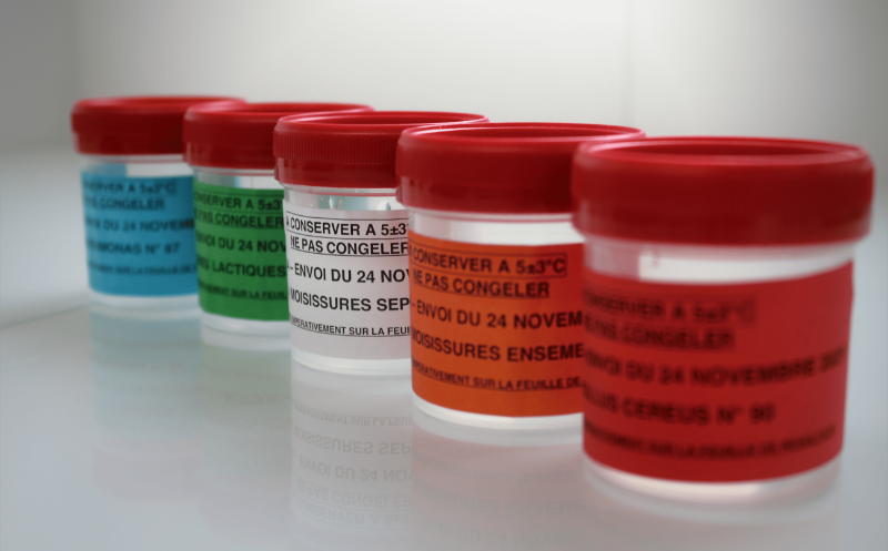 Cinq échantillons RAEMA Gel en flacons